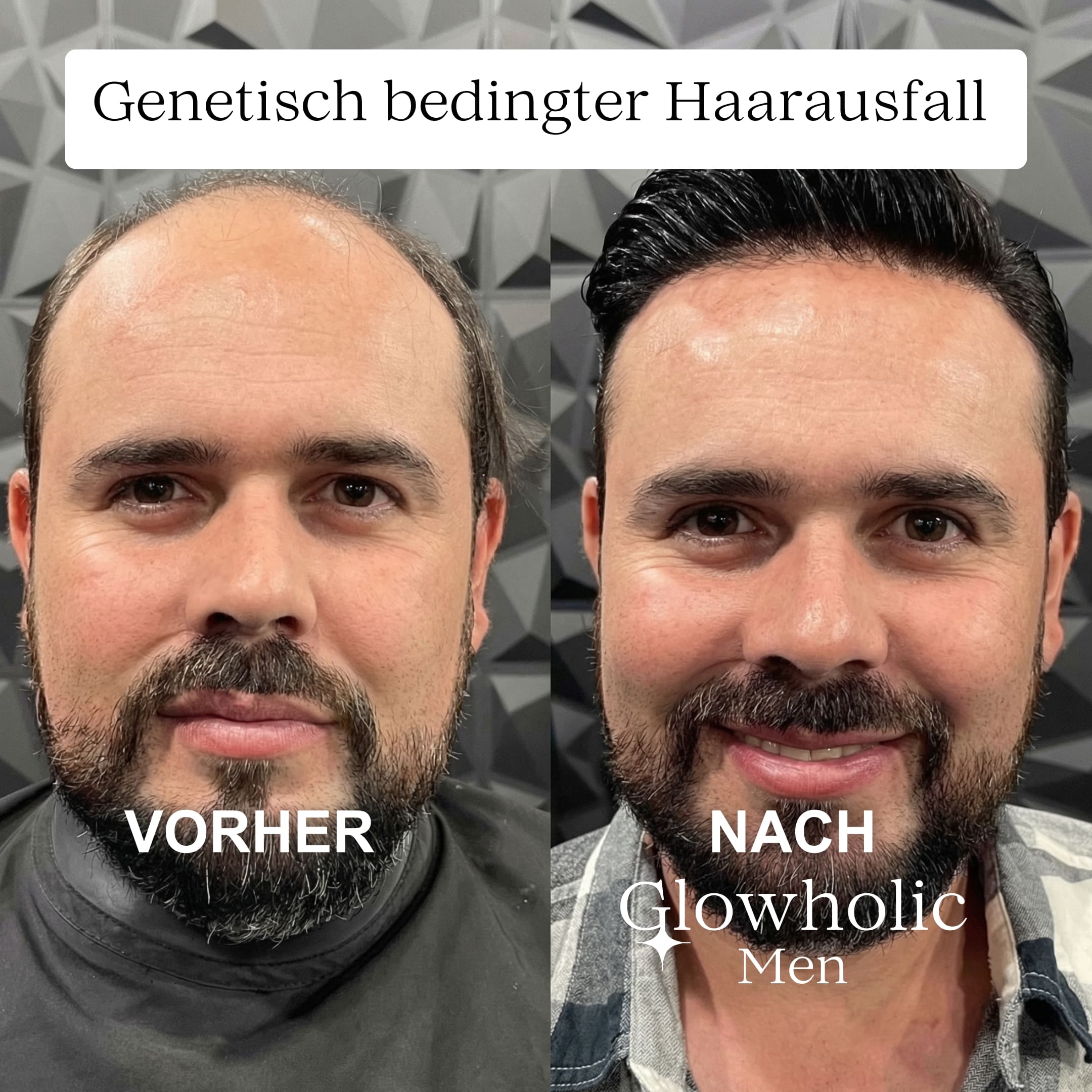 Glowholic Men - Anti-Haarausfall Starter Set - Micro-Needling Infusion für zuhause