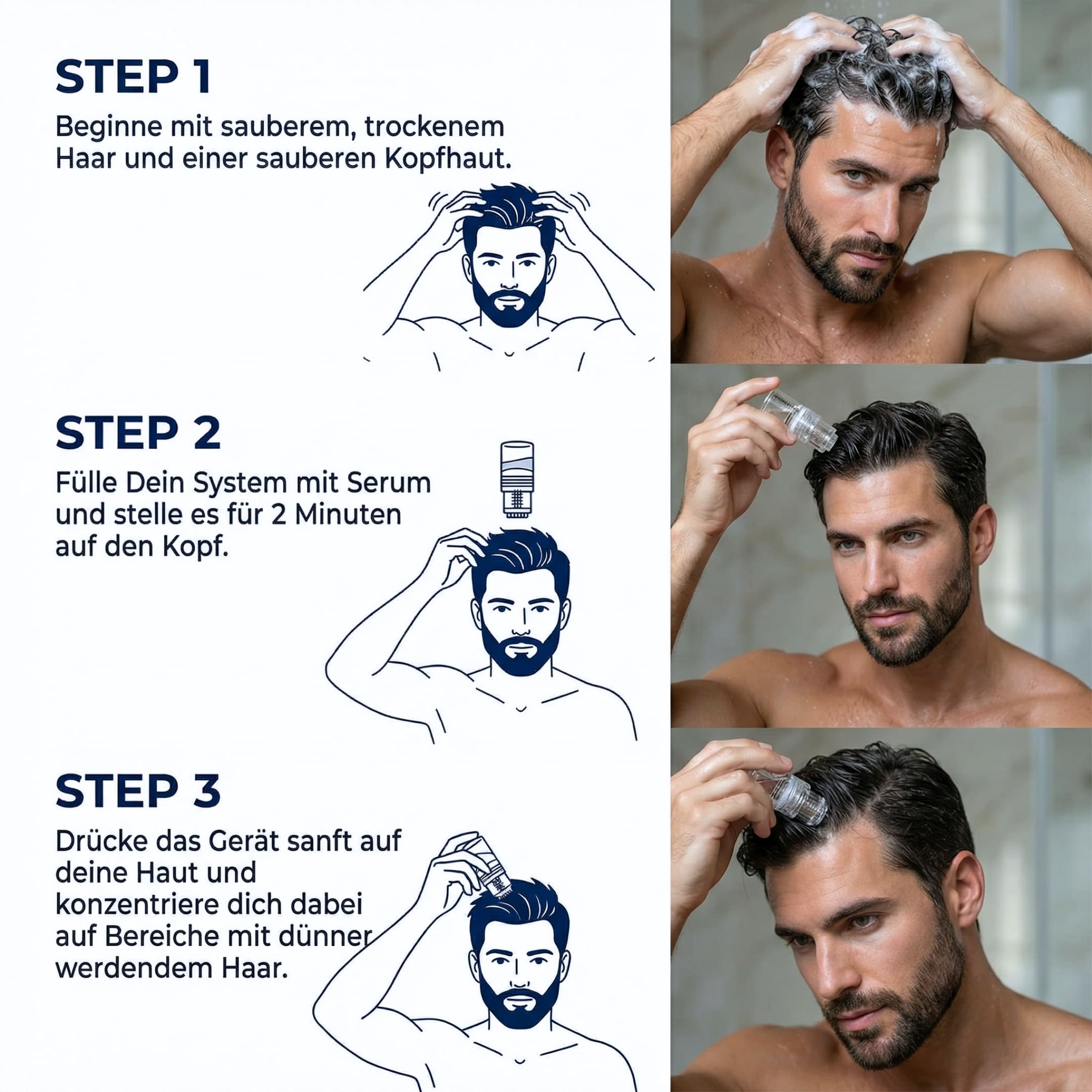 Glowholic Men - Anti-Haarausfall Starter Set - Micro-Needling Infusion für zuhause